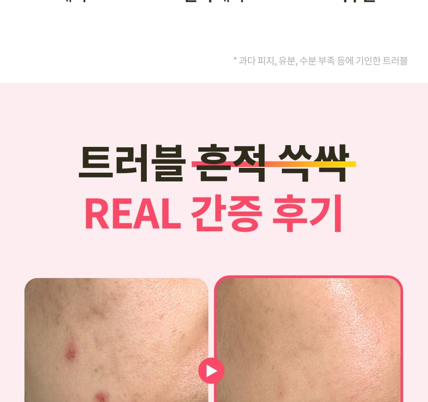 Dr.G - RED Blemish Repair Soothing Cream