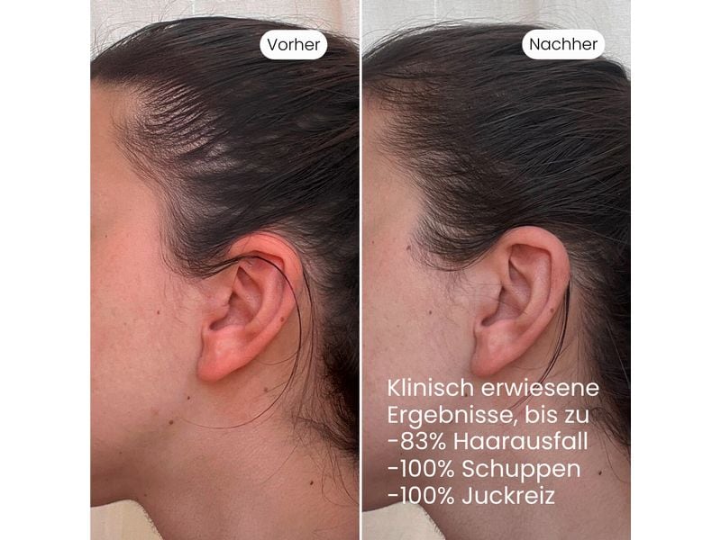 VEDIC Lab Tages-Kopfhaut-Elixier  UV 100 ml Natürliches Haarwasser gegen Haarausfall