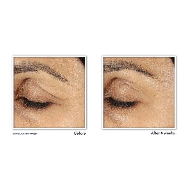 Roc Retinol Correxion Wrinkle Correct Moisturizer SPF30 30 ML