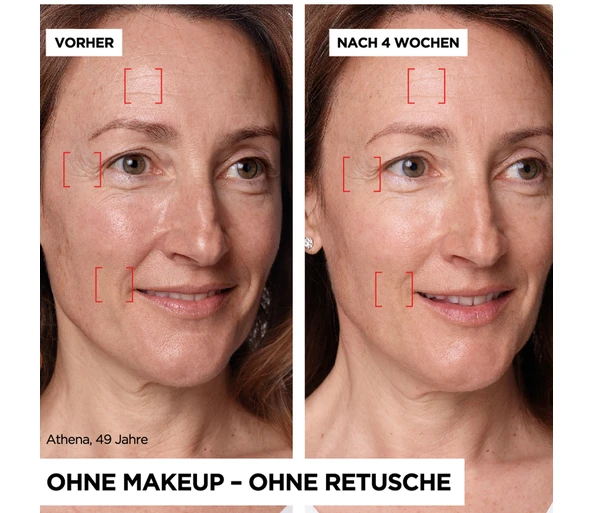L'ORÉAL PARIS Revitalift Laser X3 Anti-Age Intensiv-Pflege Tag