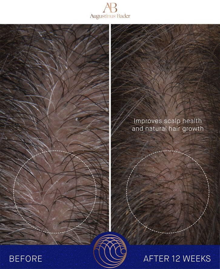 Augustinus Bader The Leave-In Hair Treatment