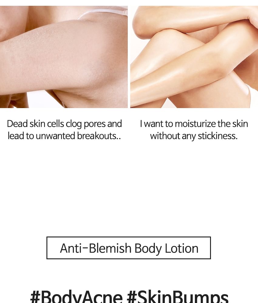 TIA'M - Anti-puistjes bodylotion voor rug en borst