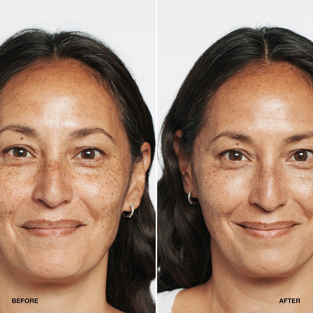 CLINIQUE Even Better Clinical™ Serum Foundation SPF 20 Oat gegen Pigmentflecken seidig-mattes Finish