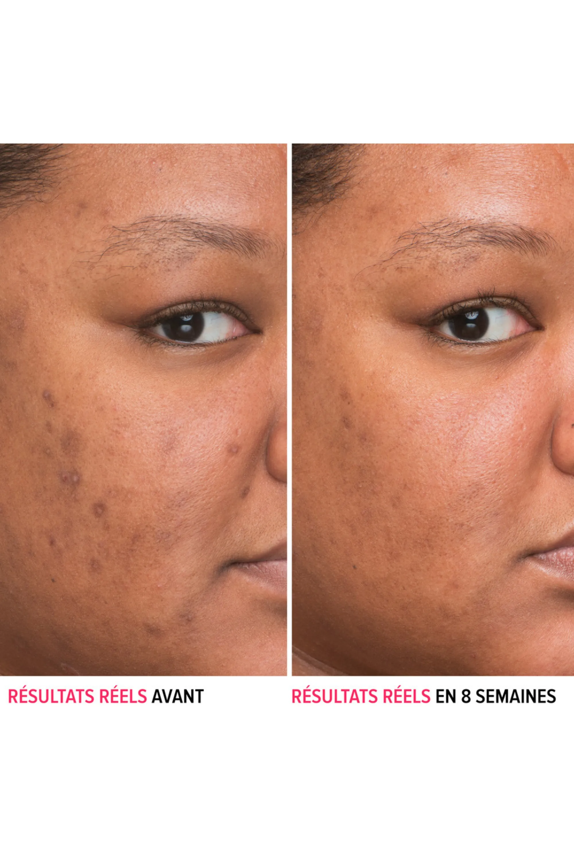 it Cosmetics Sérum anti-tâches à la niacinamide Bye Bye Serum-30 ml