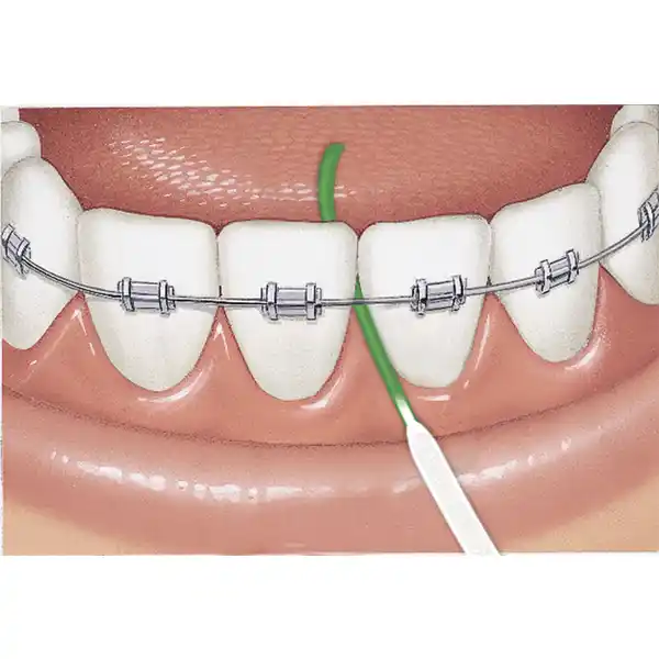 ACCESS FLOSS Zahnseide mit Einfädelhilfe für 50 Anwendungen