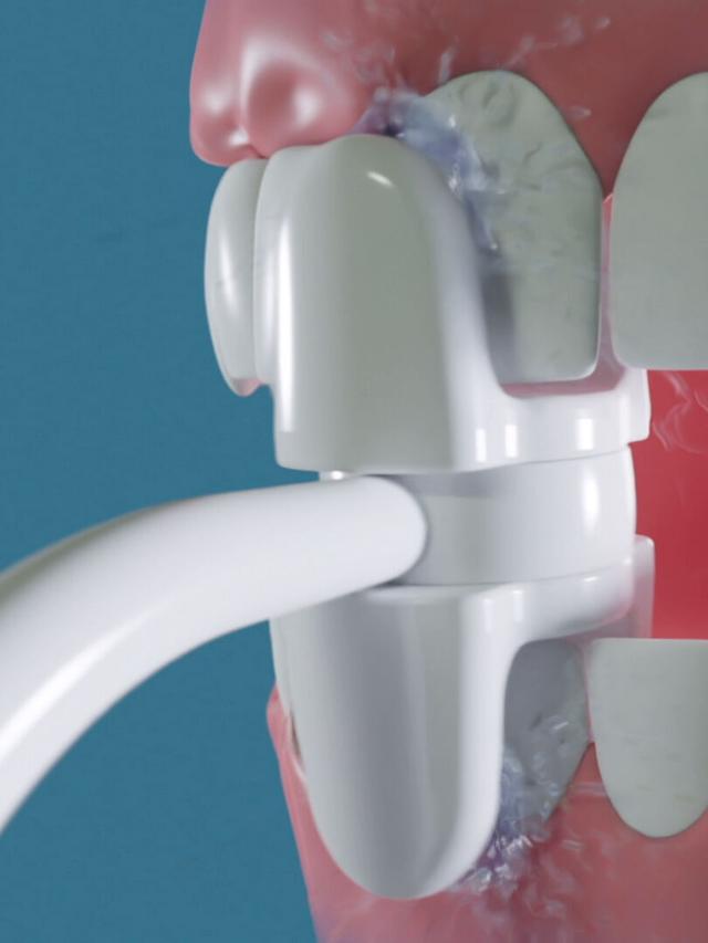 Miracle Smile elektrische Munddusche