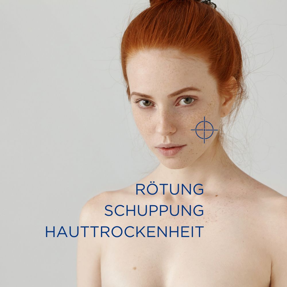 ALLERGIKA® Gesichtscreme MED - Jetzt 2 Euro sparen mit code ,,allergika2''