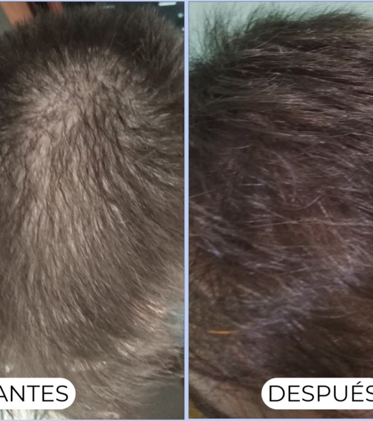 Alma Secret - Champô purificante Shikakai para cabelos normais ou oleosos