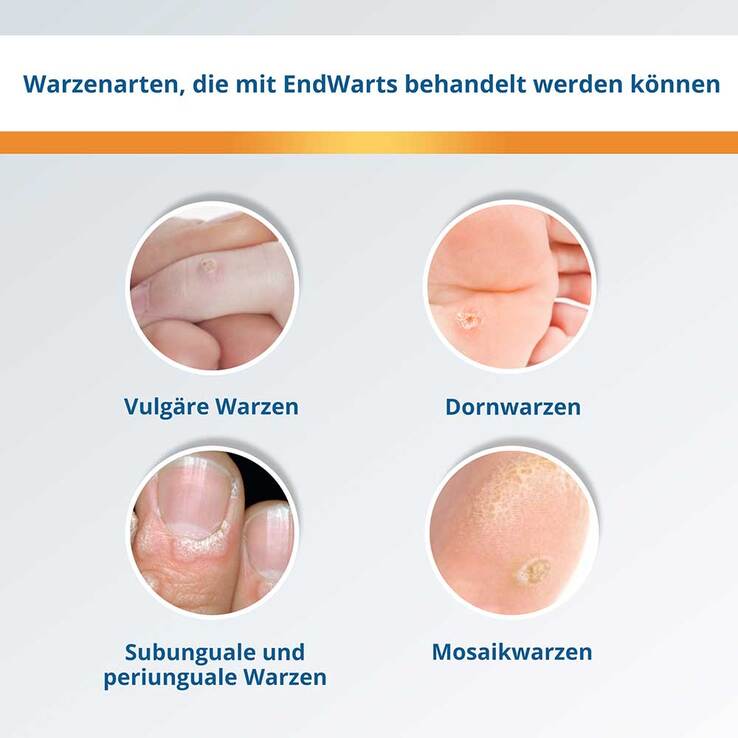 Endwarts® Pen F, 3 ml