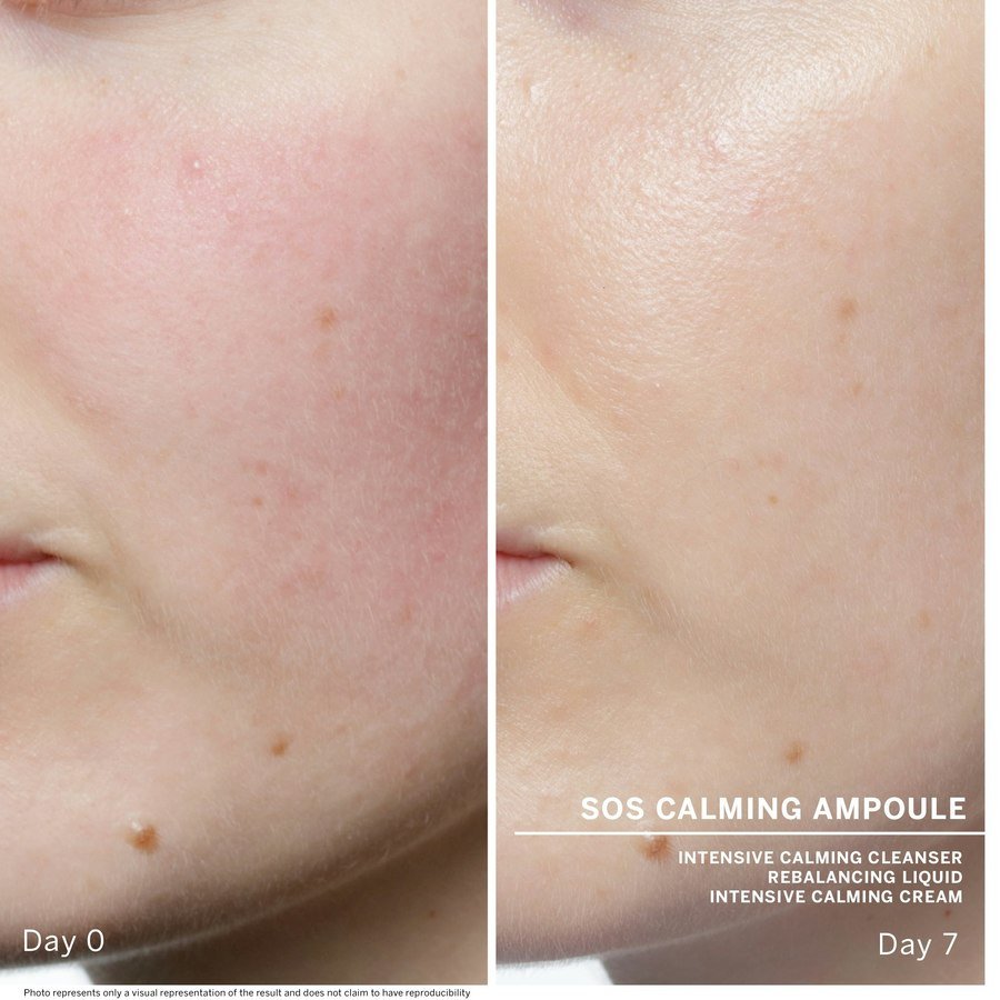 Babor Ampoule Serum Concentrates SOS Calming 7x2ml