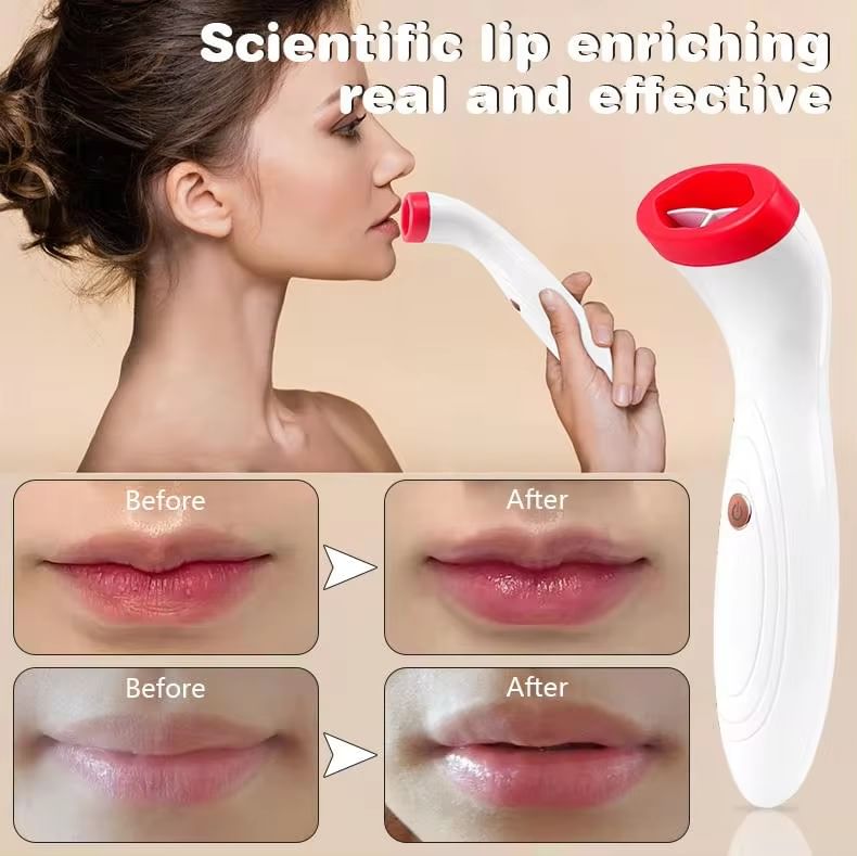 Beautyronics - USB oplaadbare lippenmassager