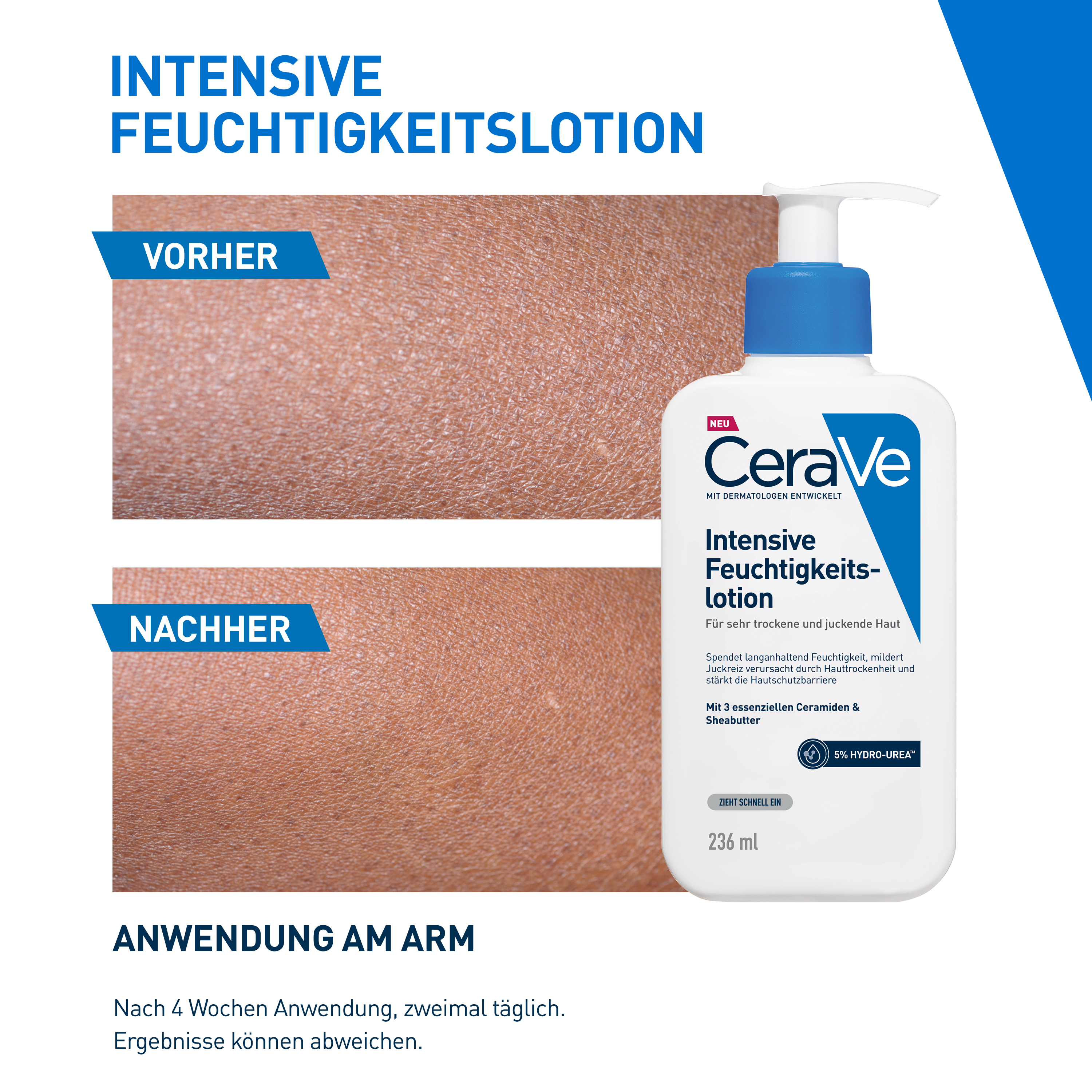 CERAVE Intensive Feuchtigkeitslotion Lot 236 ml