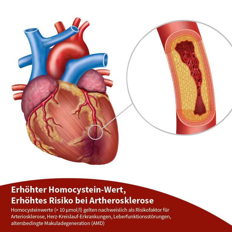 beh Arterie+
