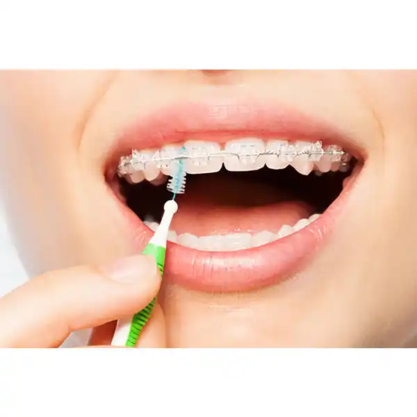 TRAV-LER® Interdentalbürste Tanne 1,1 mm grün
