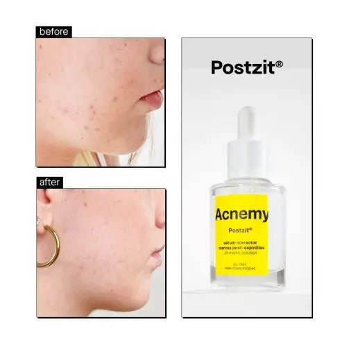 Postzit Zit Marks Solutions