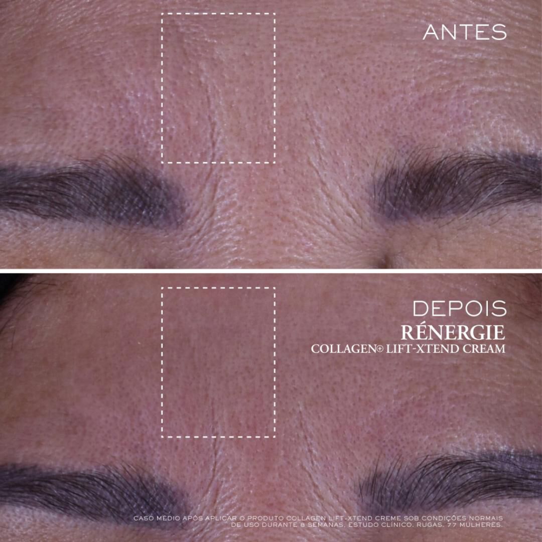Rénergie Collagen+ Lift-Xtend Creme - 50ml