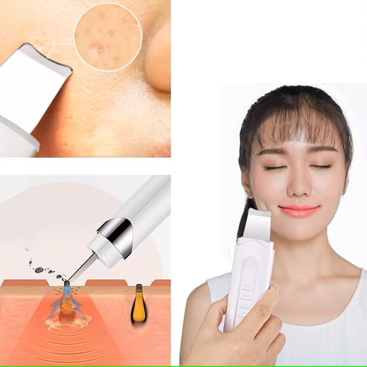 Beautyronics - USB oplaadbare huidscrubber gezichtsspatel