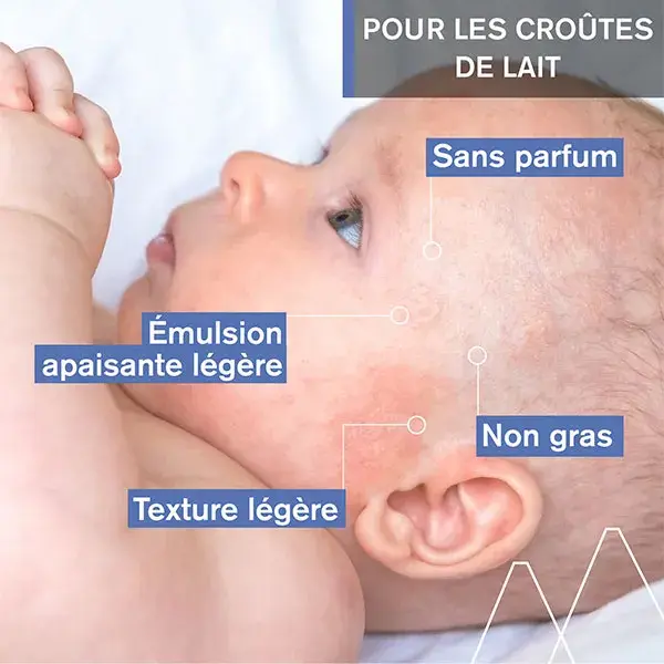 Uriage Baby 1st Calmante Purificante para Crosta Láctea 40ml