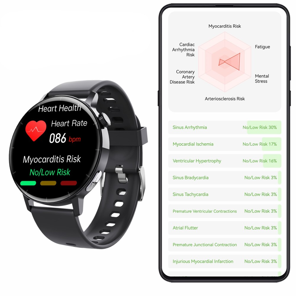 Fitness Tracker Smart Watch mit Blutsauerstoff- / Körpertemperatur- / Blutdruckmessung   EKG Funktion und 1.41