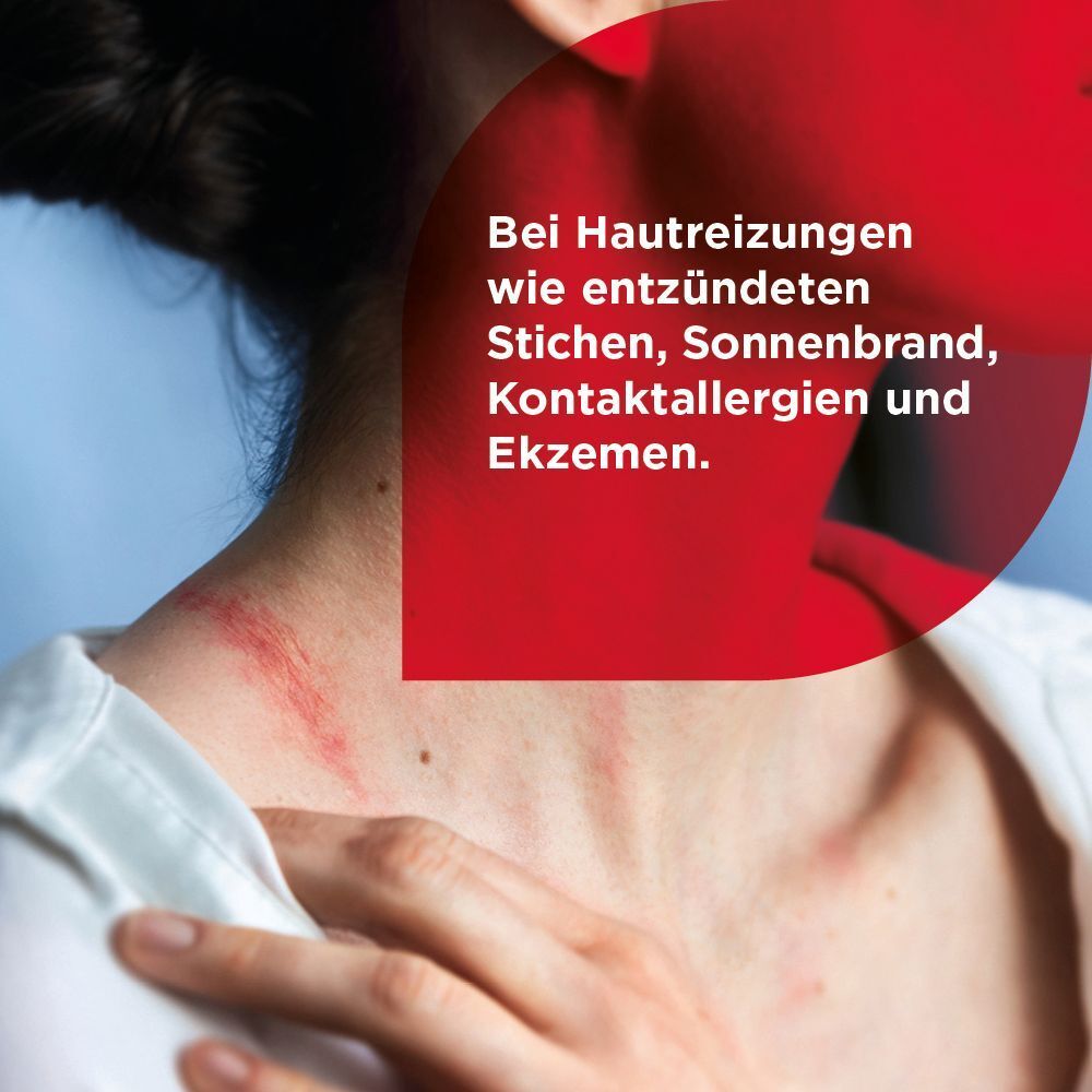 Soventol HydroCortisonACETAT 0,5% Hautentzündungen