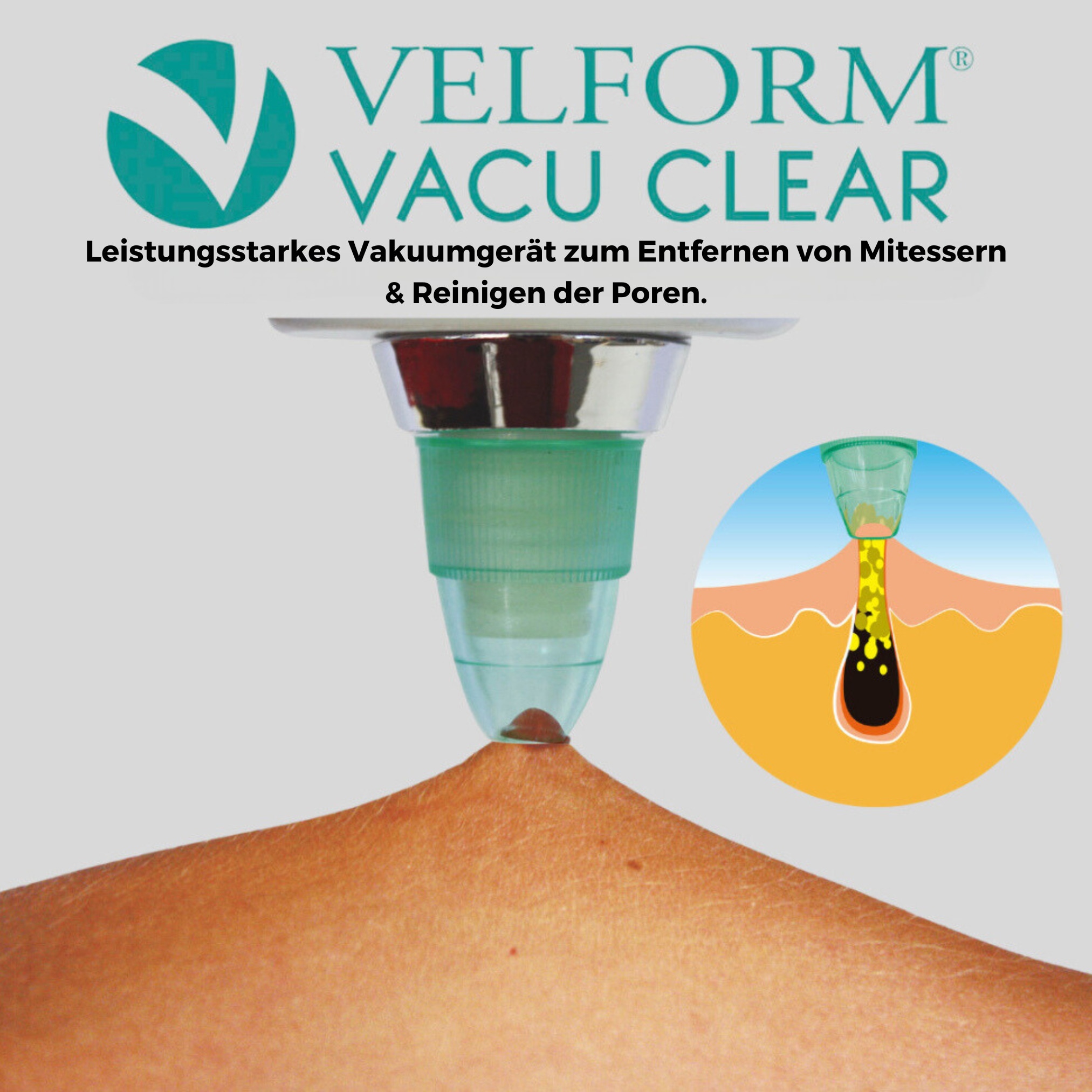 Velform® Mitesserentferner - Porenreiniger Gesicht - Porensauger Vacu Clear