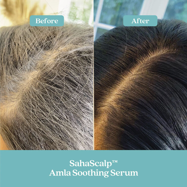 Fable & Mane SahaScalp - Amla Soothing Scalp and Hair Serum