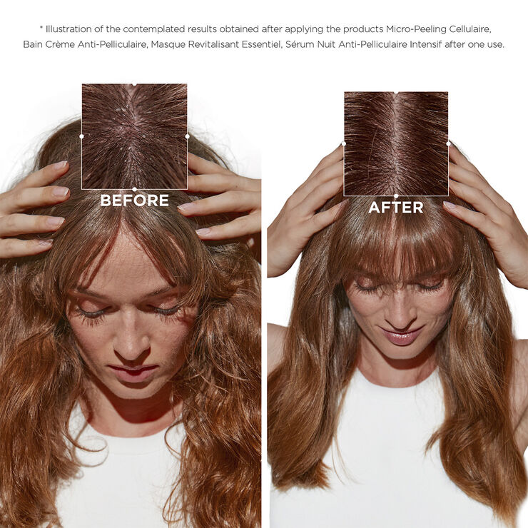 Kérastase Symbiose Micropeel Treatment