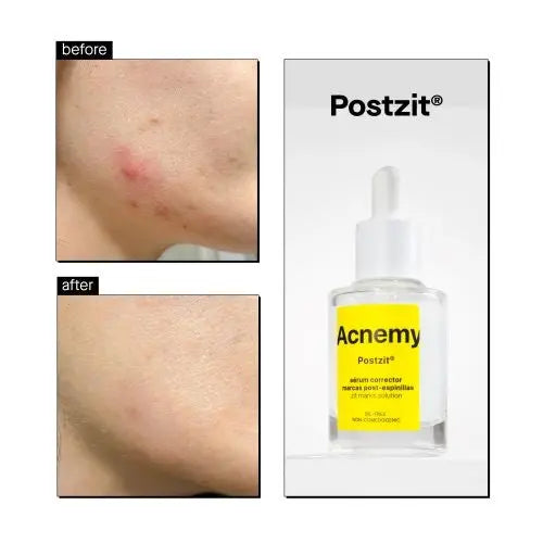 Postzit Zit Marks Solutions