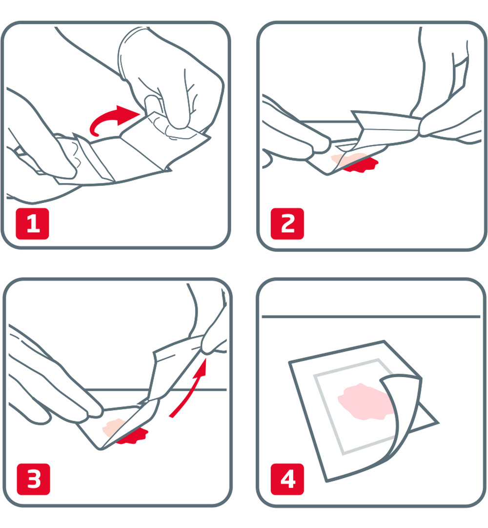 Leukoplast Cuticell Contact 5 x 7,5 cm (5 stuks)