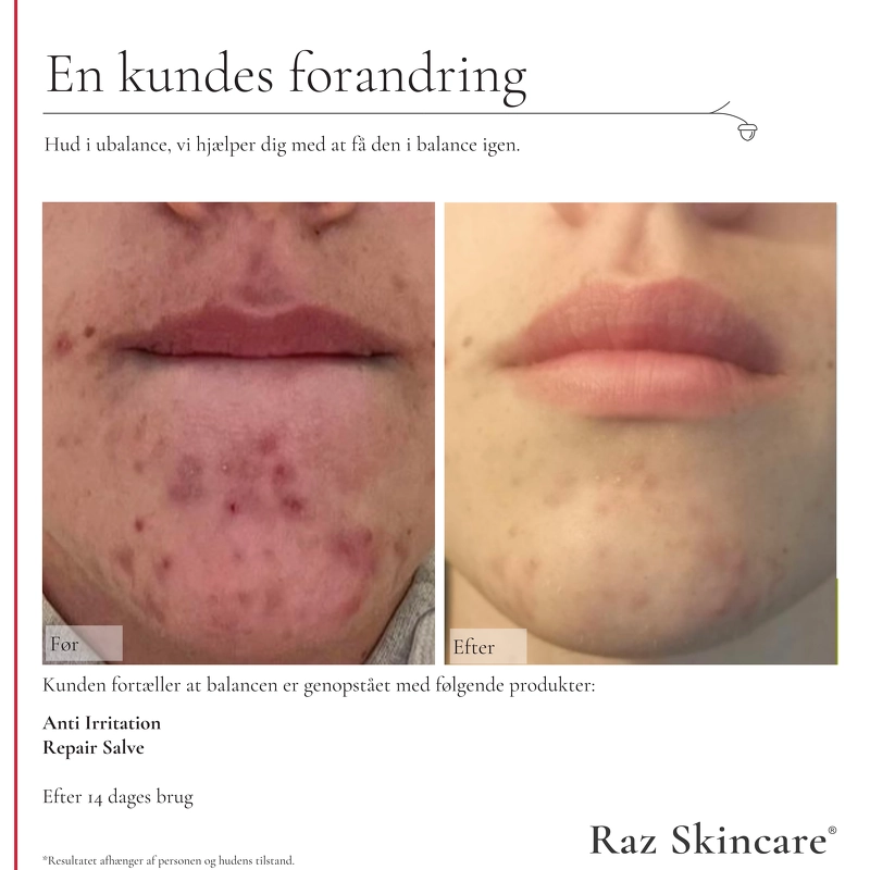 Raz Skincare Repair Perfume Free 100 ml