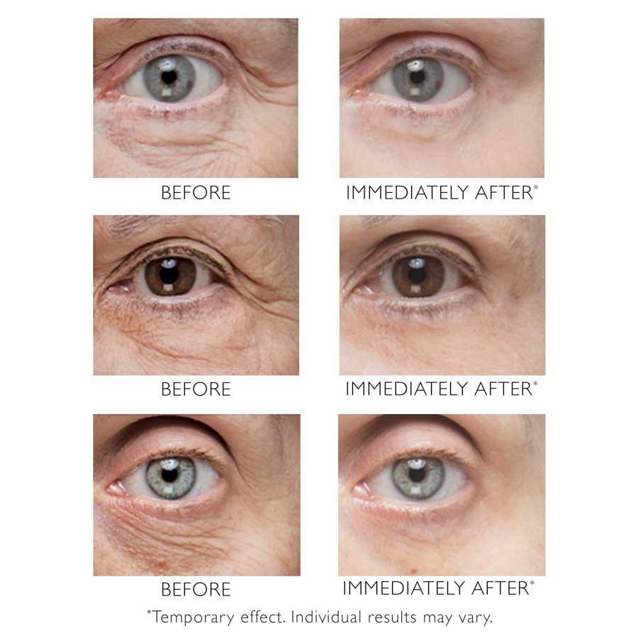 Peter Thomas Roth Firmx Instant Firm Eye Tightener 30ml