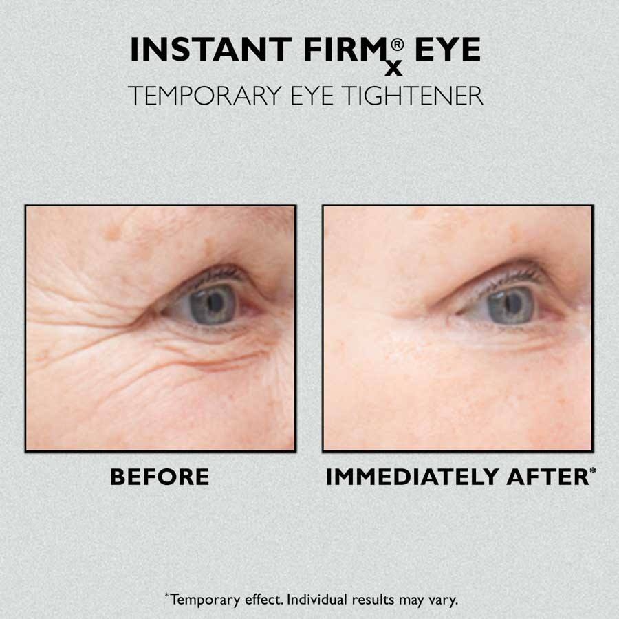 Peter Thomas Roth Firmx Instant Firm Eye Tightener 30ml