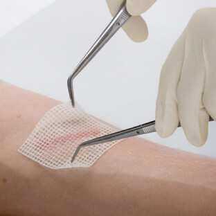 Leukoplast Eerste hulp bij Brandwonden - 3 Stuks
