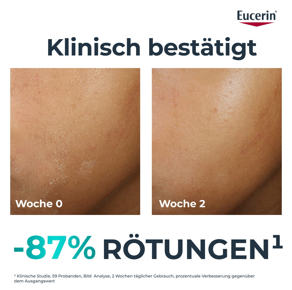 EUCERIN Dermopure Clinical Feuchtigkeitspflege<br>40 ml, therapiebegleitend