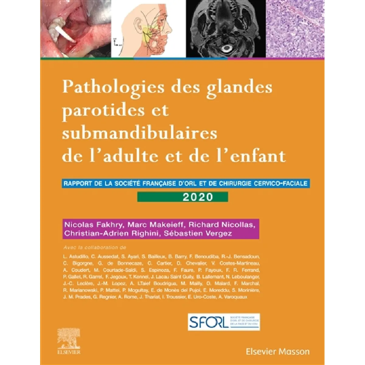 Pathologies des glandes parotides et submandibulaires de l'adulte et de l'enfant : rapport de la Société française d'ORL et de chirurgie cervico-faciale 2020 · Occasion