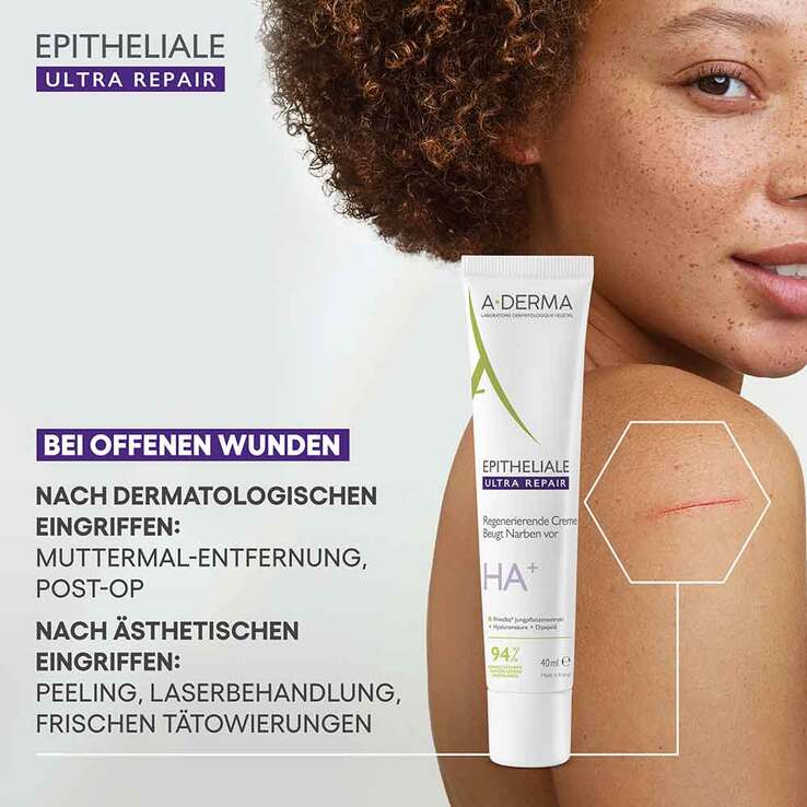 A-Derma Epitheliale Ultra Repair Creme, 40 ml