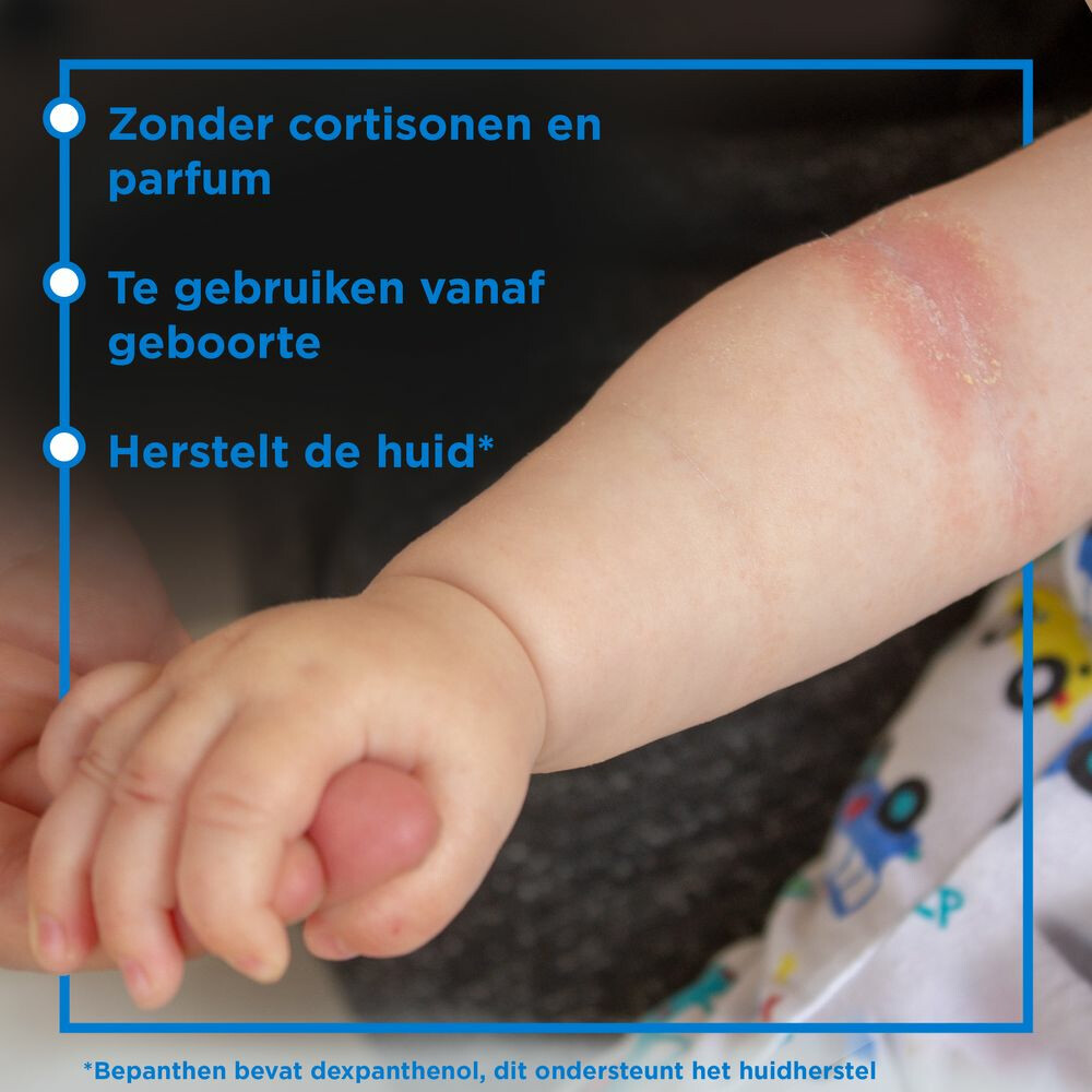 Bepanthen Eczeem Crème Baby20 gr