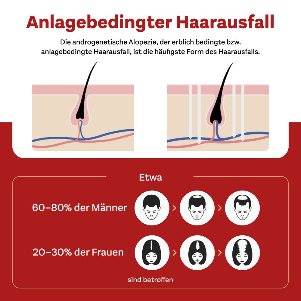 MINOXIDIL DoppelherzPharma 50 mg/ml
