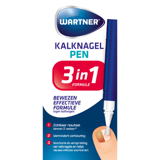 Wartner Kalknagelpen 4ML