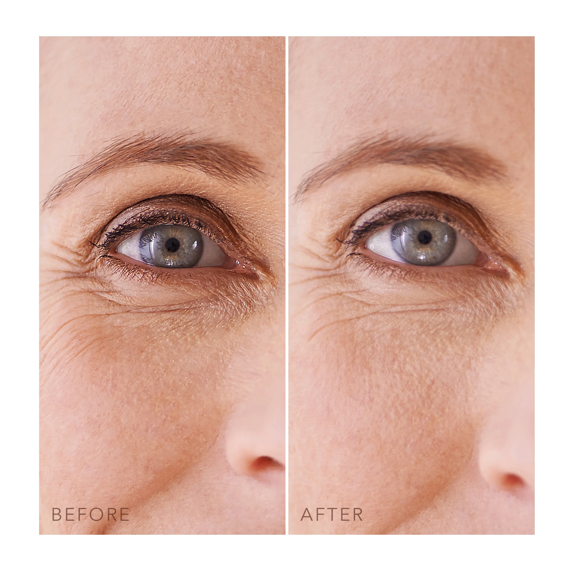 IRIS(TM) Hydrating Hydrogel Eye Mask |