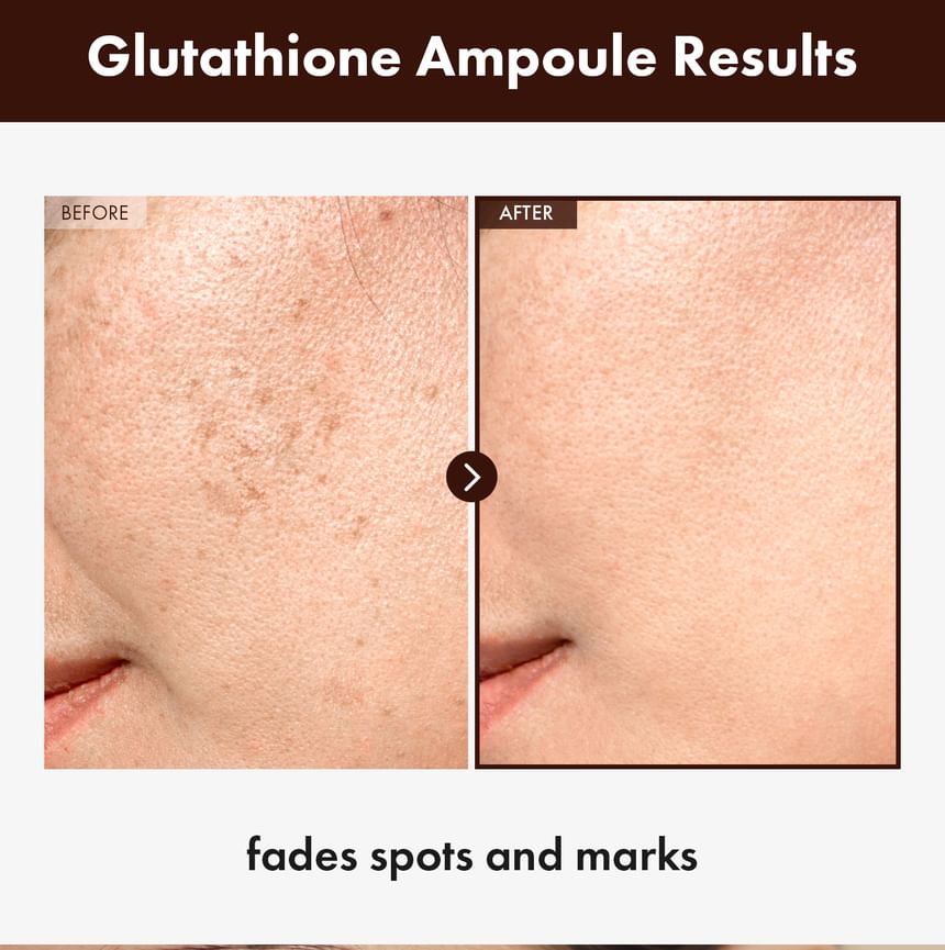 TOSOWOONG - Glutathion Ampul