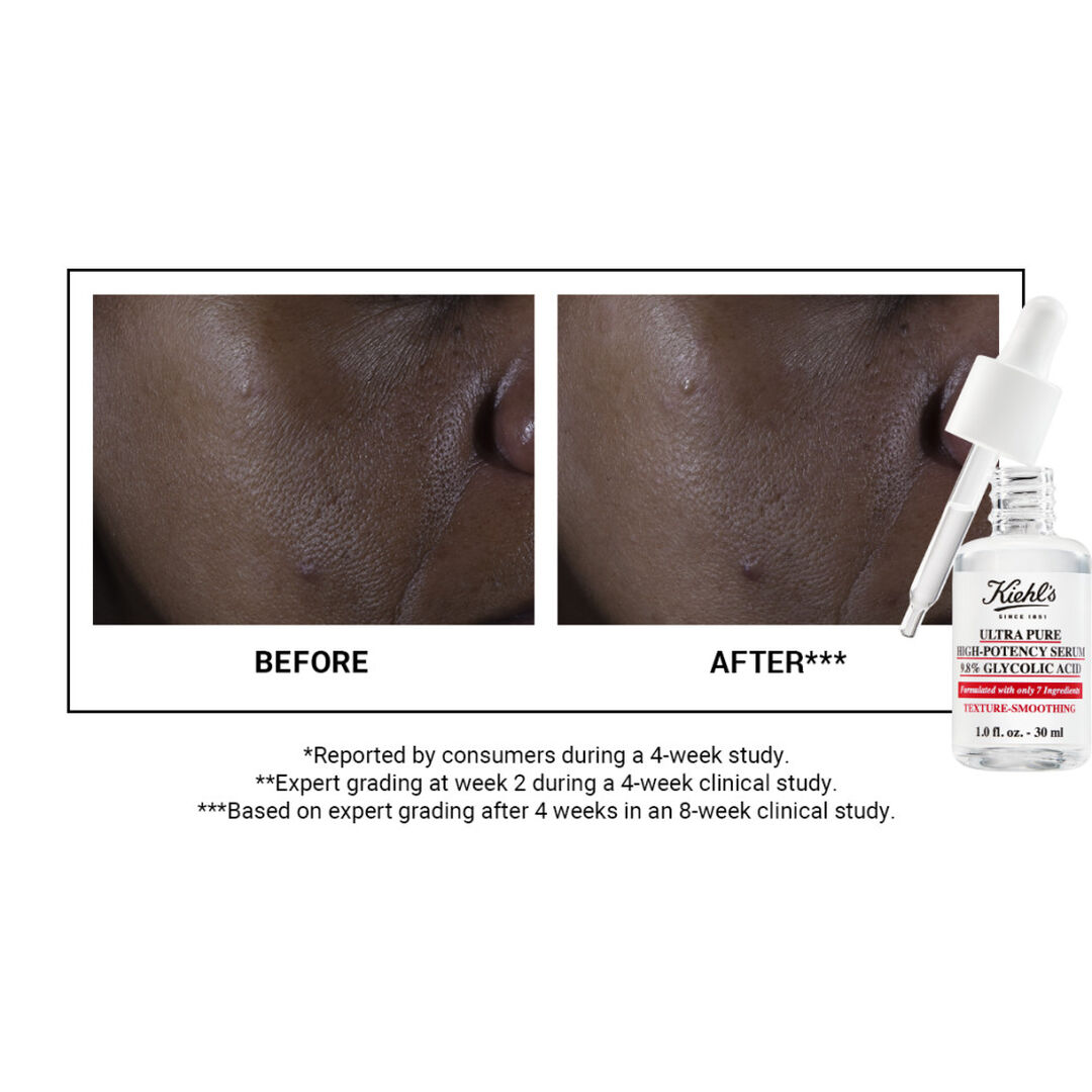 KIEHL'S Pure Serums Ultra Pure High-Potency Serum 9.8% Glycolic Acid - 30ml