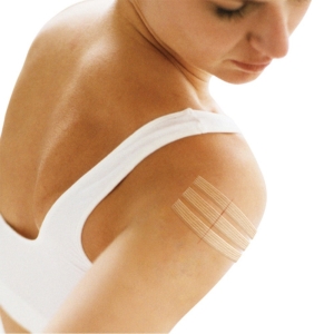 3M STERI STRIP weiss 2 Grössen gemischt , 8 Stück