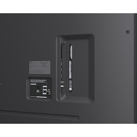 LG 75
