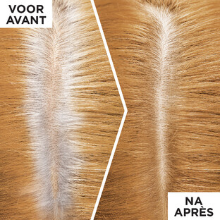 L'Oréal Paris Magic Retouch 5 Middenblond 1ST