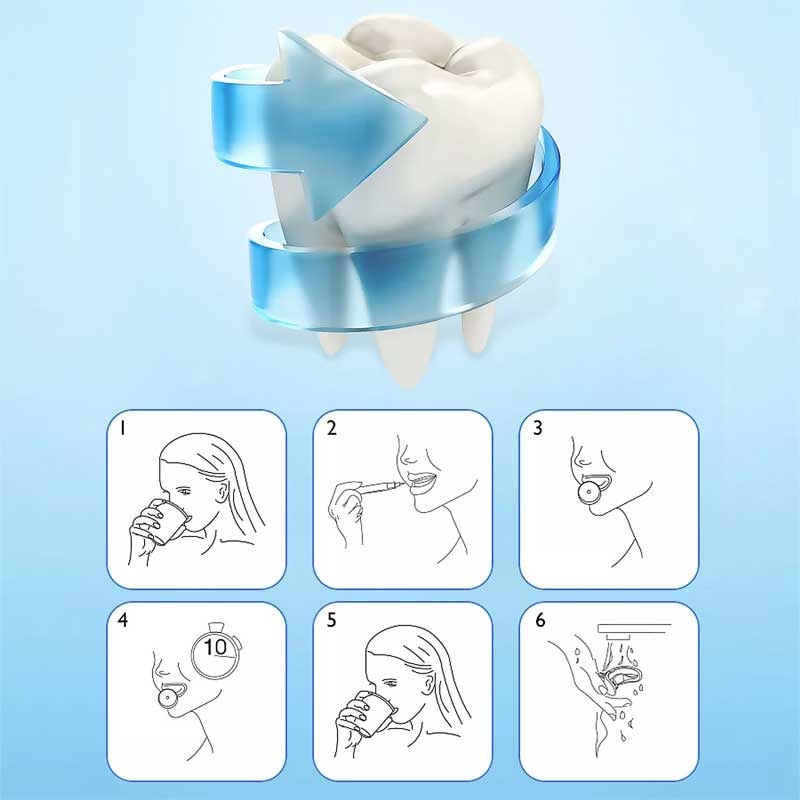 Appareil blanchisseur de dents LED - Blanc