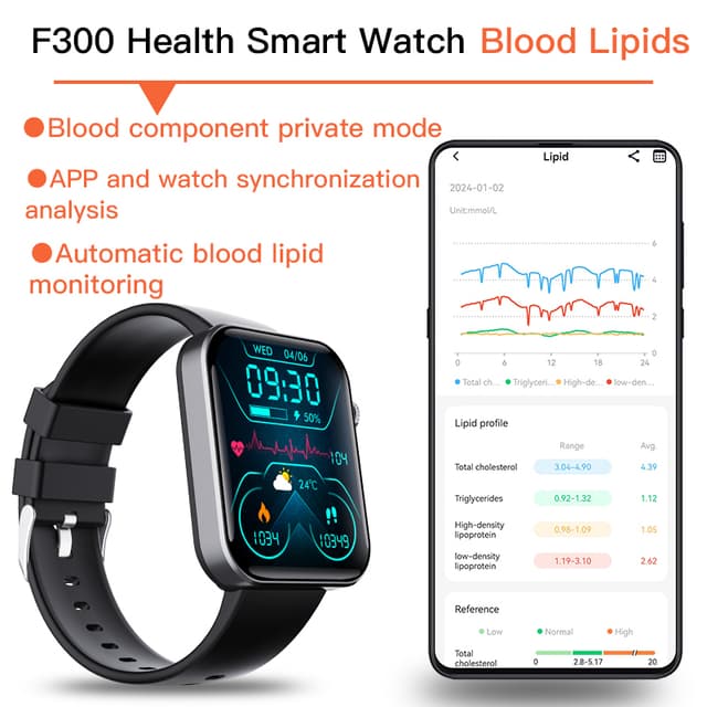 Smartwatch