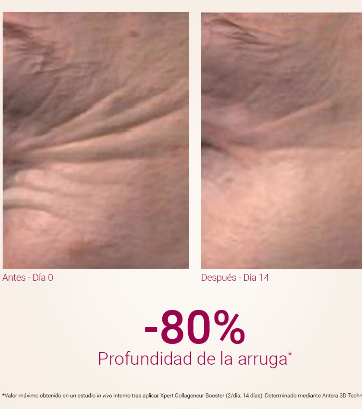 Primaderm - Tratamento intensivo de rugas Xpert Collageneur Booster - 2x10ml