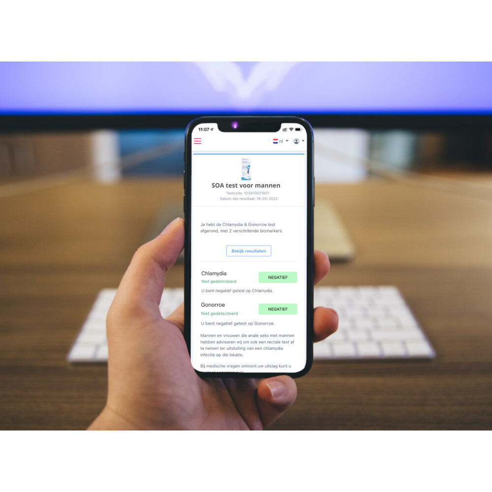 Homed-IQ Zelftest SOA Voor Mannen