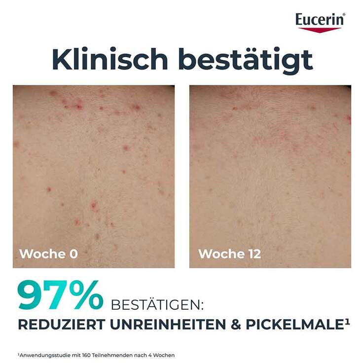 Eucerin Dermopure Clinical Körperpflege erneuernd, 200 ml